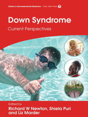 cover image of Down Syndrome
